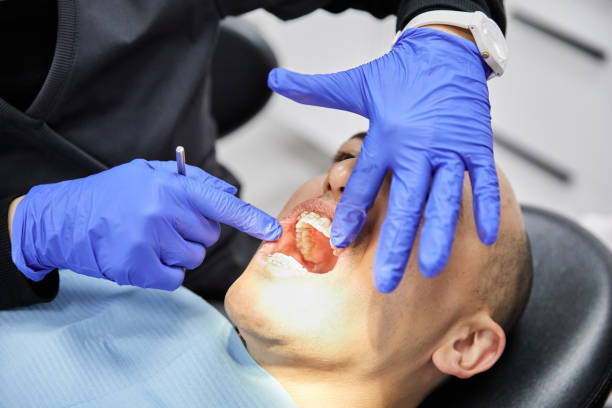 Best Emergency Treatment for Toothache in Cross Roads, TX
