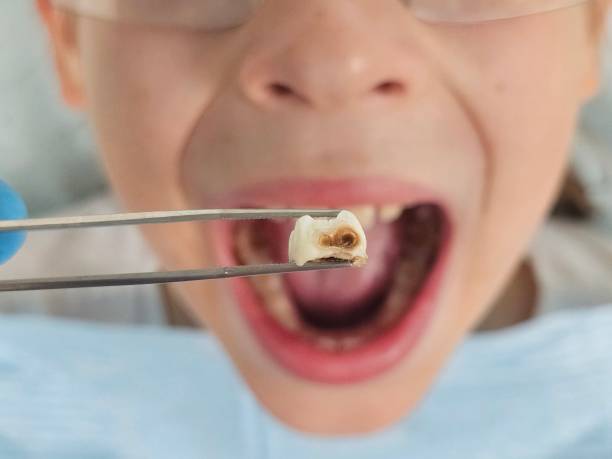 Best Emergency Dental Care for Trauma or Injury in Cross Roads, TX