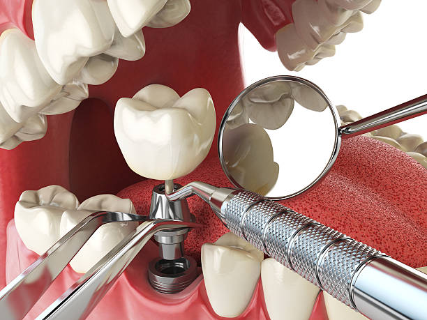 Best Same-Day Emergency Dentist in Cross Roads, TX