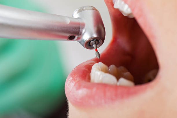 Best Same-Day Emergency Dentist in Cross Roads, TX